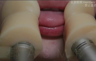 其实是椰子啦2025-2-10内容硅胶耳管麦天鹅